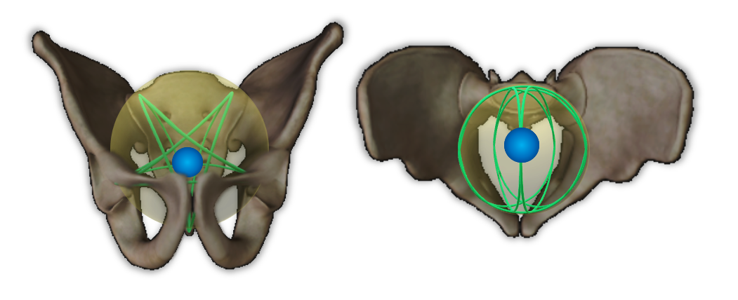 Sacral Aster within pelvis from 2 perspectives
